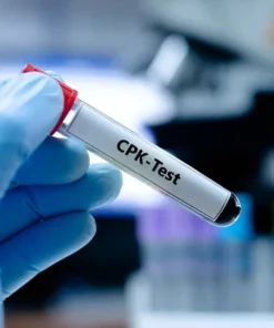 CPK, BB FRACTION, SERUM