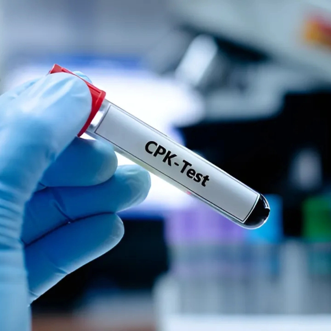 CPK, BB FRACTION, SERUM