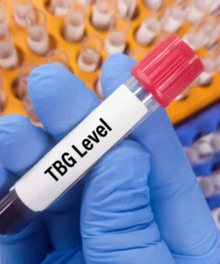 THYROXINE BINDING GLOBULIN (TBG)