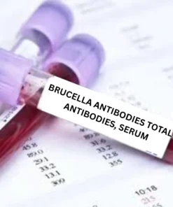 BRUCELLA ANTIBODIES TOTAL ANTIBODIES, SERUM
