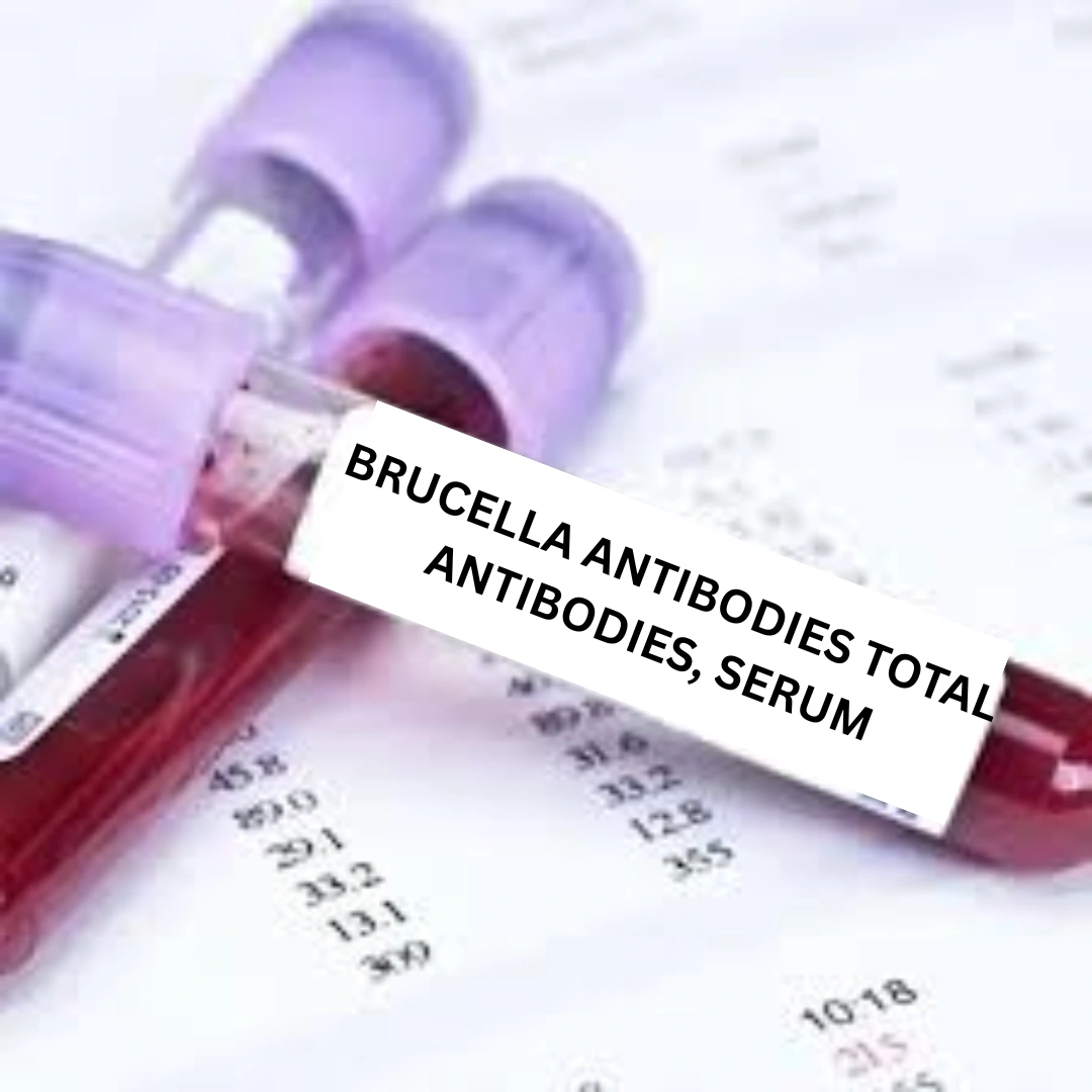 BRUCELLA ANTIBODIES TOTAL ANTIBODIES, SERUM