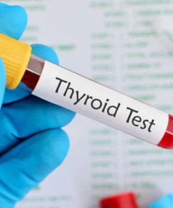 THYROID STIMULATING HORMONE(ULTRASENSITIVE TSH),SERUM