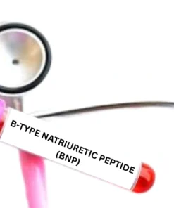 B-TYPE NATRIURETIC PEPTIDE (BNP)