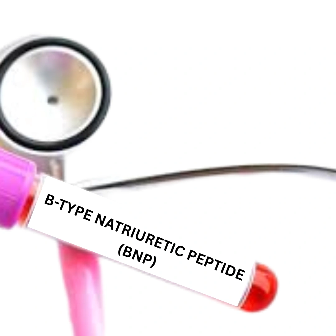 B-TYPE NATRIURETIC PEPTIDE (BNP)