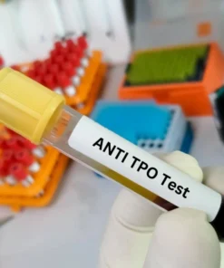 THYROID PEROXIDASE ANTI- BODIES (ANTI TPO) , SERUM