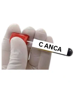C ANCA