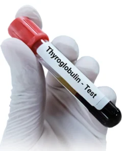 THYROGLOBULIN, SERUM