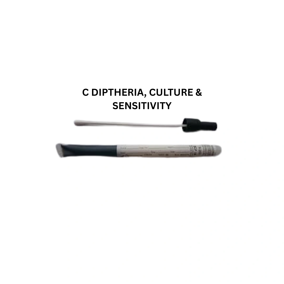 C DIPTHERIA, CULTURE & SENSITIVITY