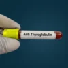 THYROGLOBULIN ANTIBODY (ANTI TG), SERUM