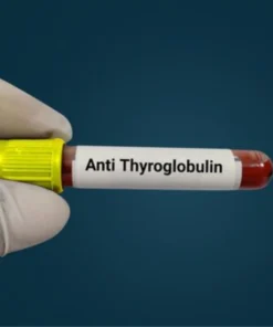 THYROGLOBULIN ANTIBODY (ANTI TG), SERUM