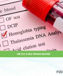 HB,TLC & DLC WHOLE BLOOD