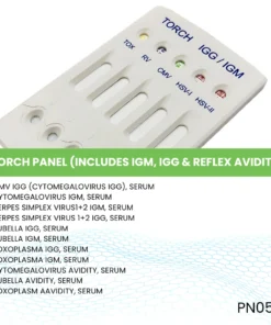 TORCH PANEL (INCLUDES IGM, IGG & REFLEX AVIDITY)