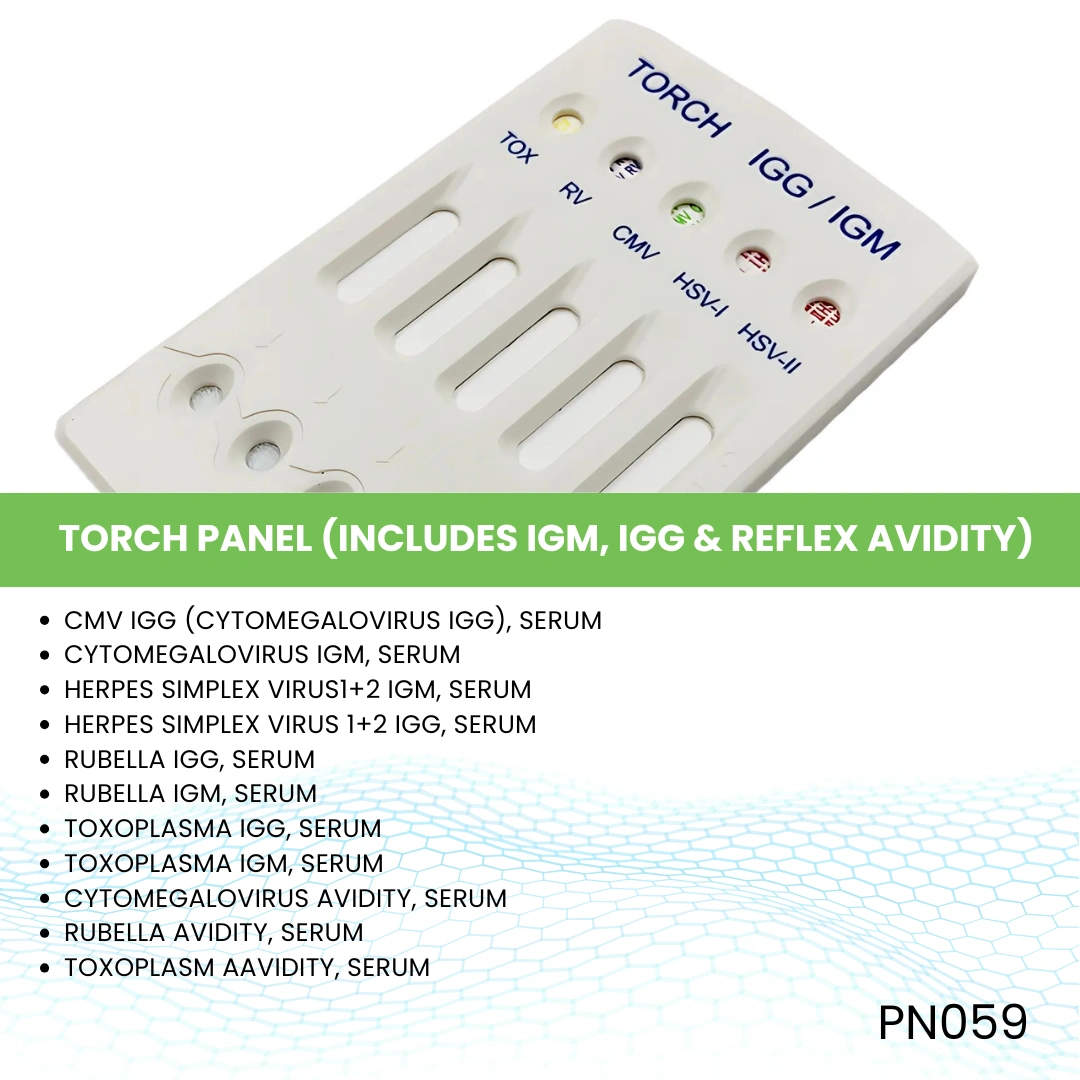TORCH PANEL (INCLUDES IGM, IGG & REFLEX AVIDITY)