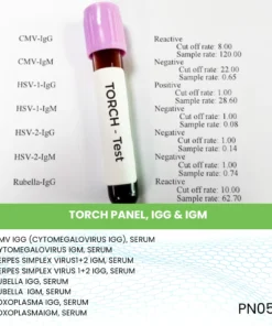 TORCH PANEL, IGG & IGM