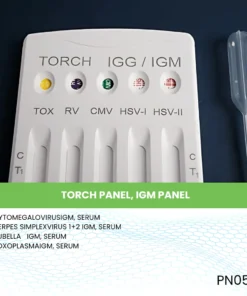 TORCH PANEL, IGM PANEL