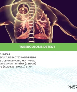 TUBERCULOSIS DETECT