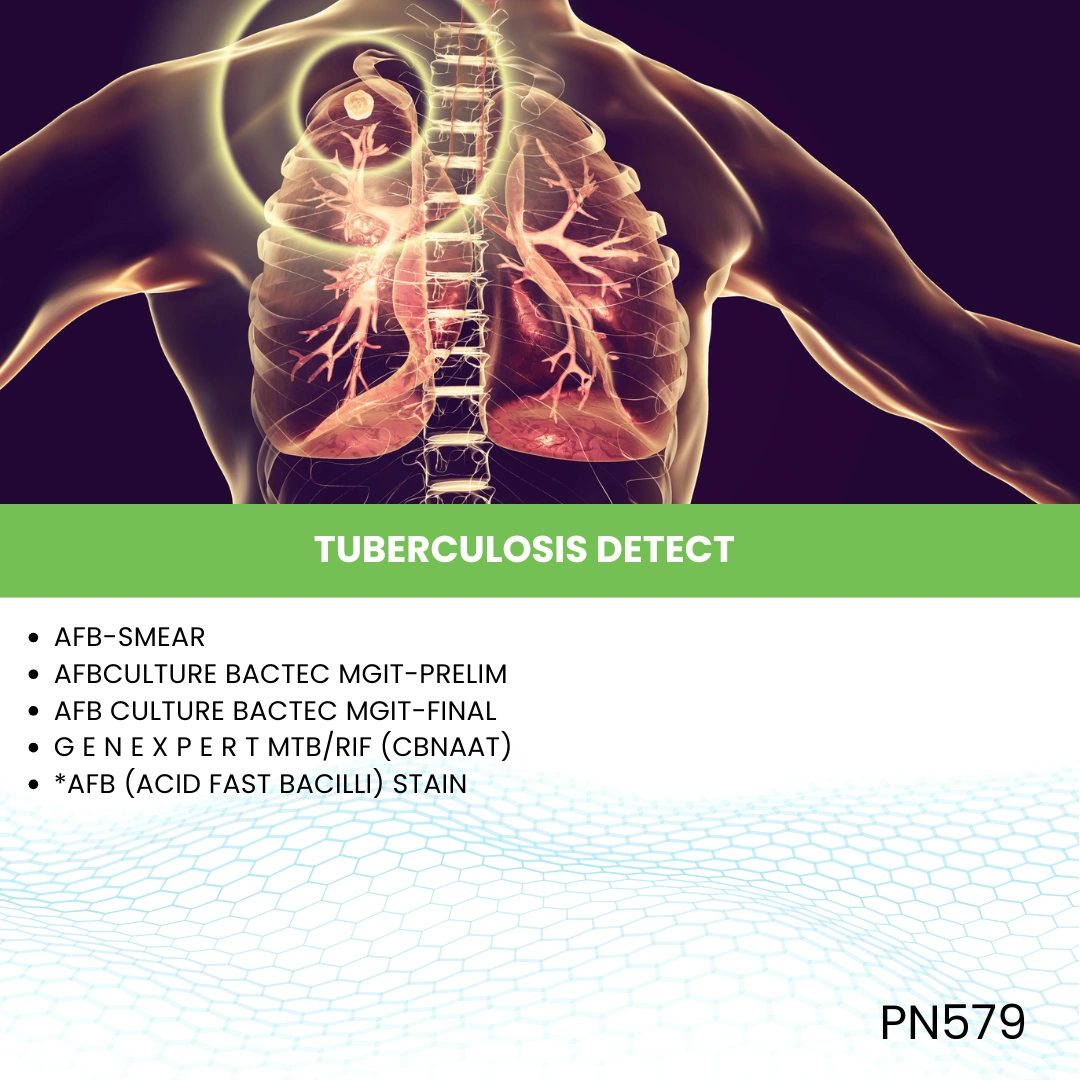TUBERCULOSIS DETECT