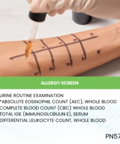 ALLERGY SCREEN