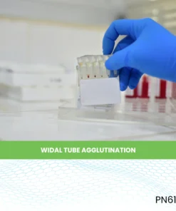 WIDAL TUBE AGGLUTINATION