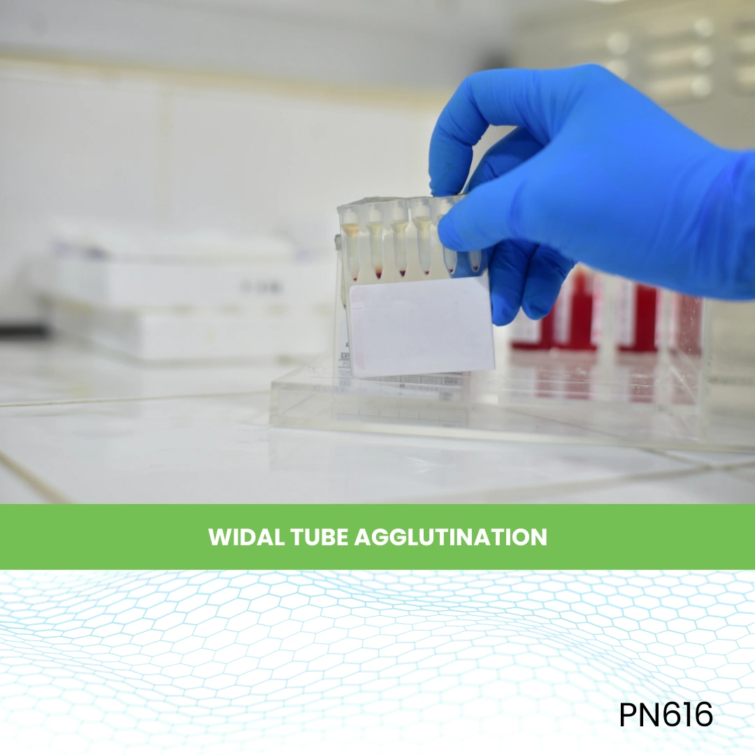 WIDAL TUBE AGGLUTINATION