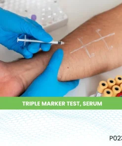 TRIPLE MARKER TEST, SERUM
