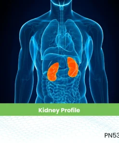 Kidney Profile.