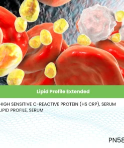 Lipid Profile Extended