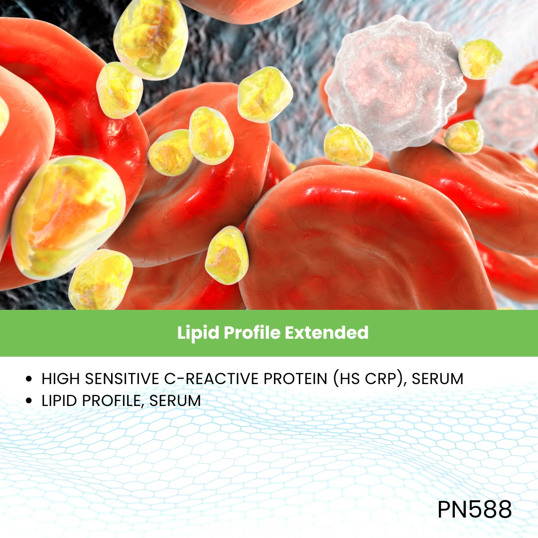 Lipid Profile Extended