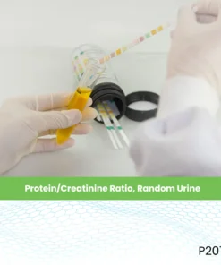 Protein/Creatinine Ratio, Random Urine