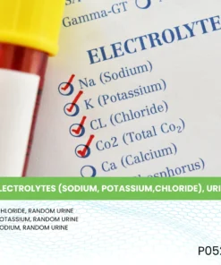 ELECTROLYTES (SODIUM, POTASSIUM,CHLORIDE), URINE