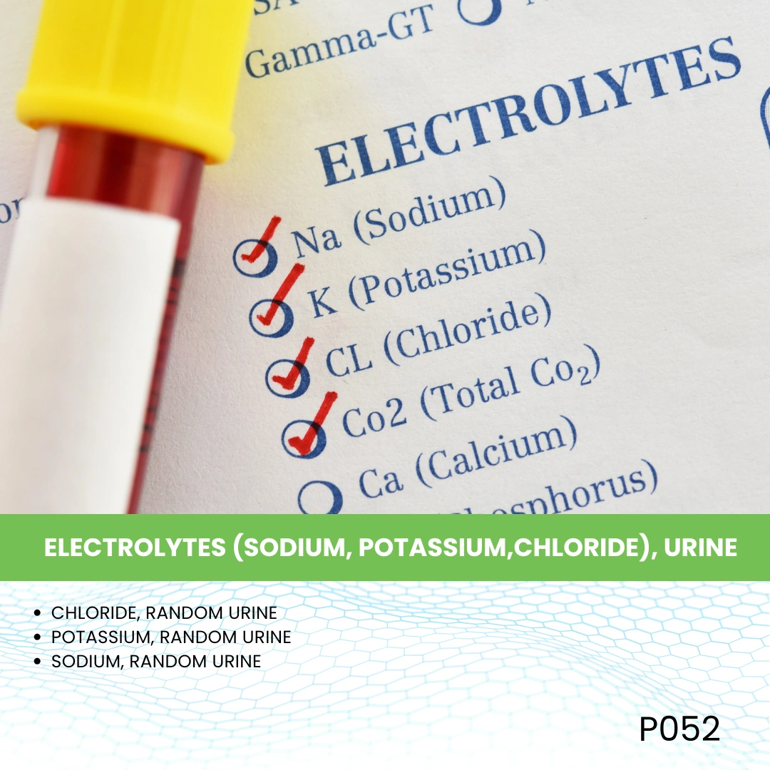 ELECTROLYTES (SODIUM, POTASSIUM,CHLORIDE), URINE