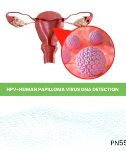 Hpv-Human Papilloma Virus Dna Detection