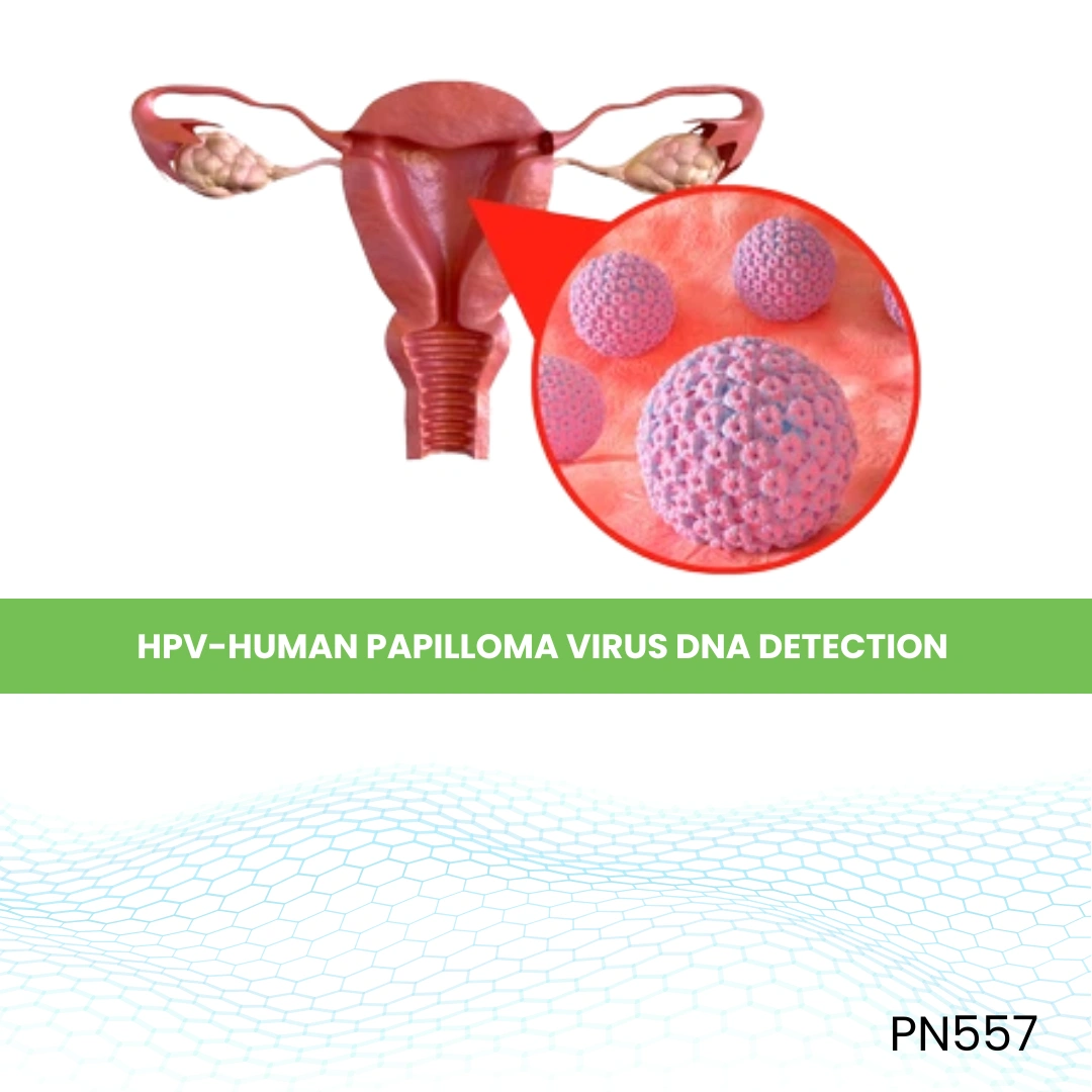Hpv-Human Papilloma Virus Dna Detection