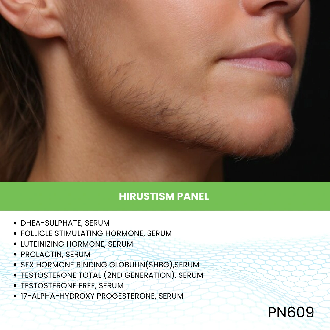 Hirsutism Panel