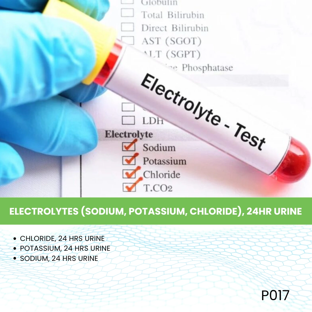 ELECTROLYTES (SODIUM, POTASSIUM, CHLORIDE), 24HR URINE