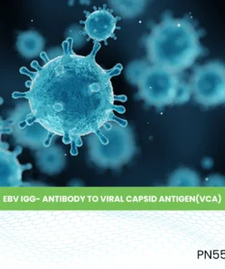 EBV IGG- ANTIBODY TO VIRAL CAPSID ANTIGEN(VCA)