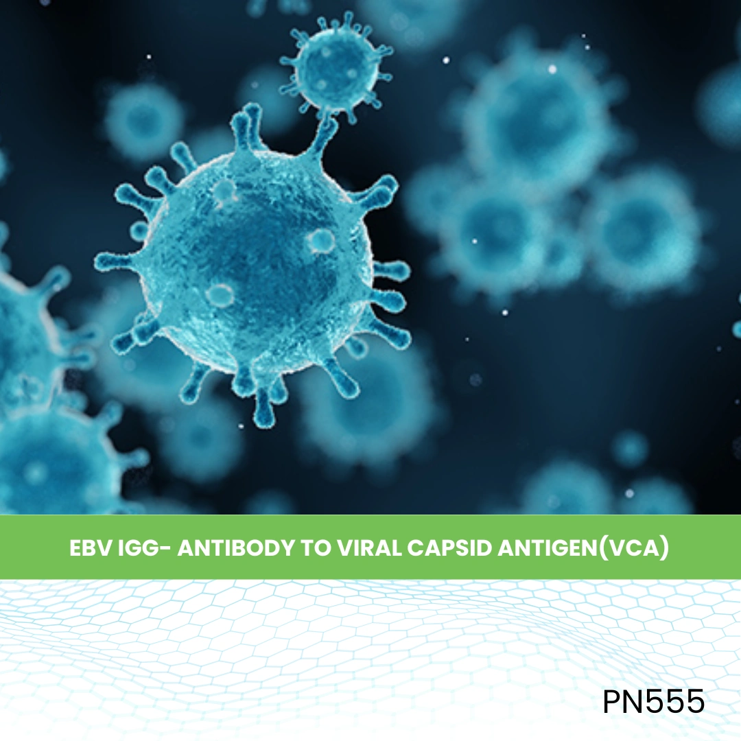 EBV IGG- ANTIBODY TO VIRAL CAPSID ANTIGEN(VCA)