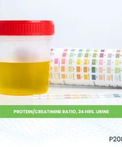Protein/Creatinine Ratio, 24 Hrs. Urine