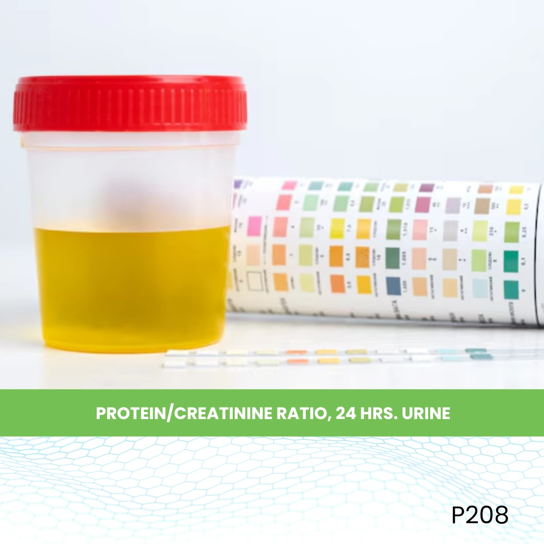 Protein/Creatinine Ratio, 24 Hrs. Urine