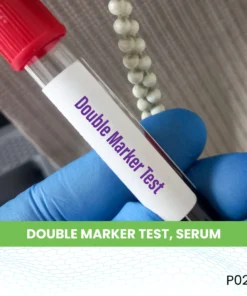 DOUBLE MARKER TEST, SERUM