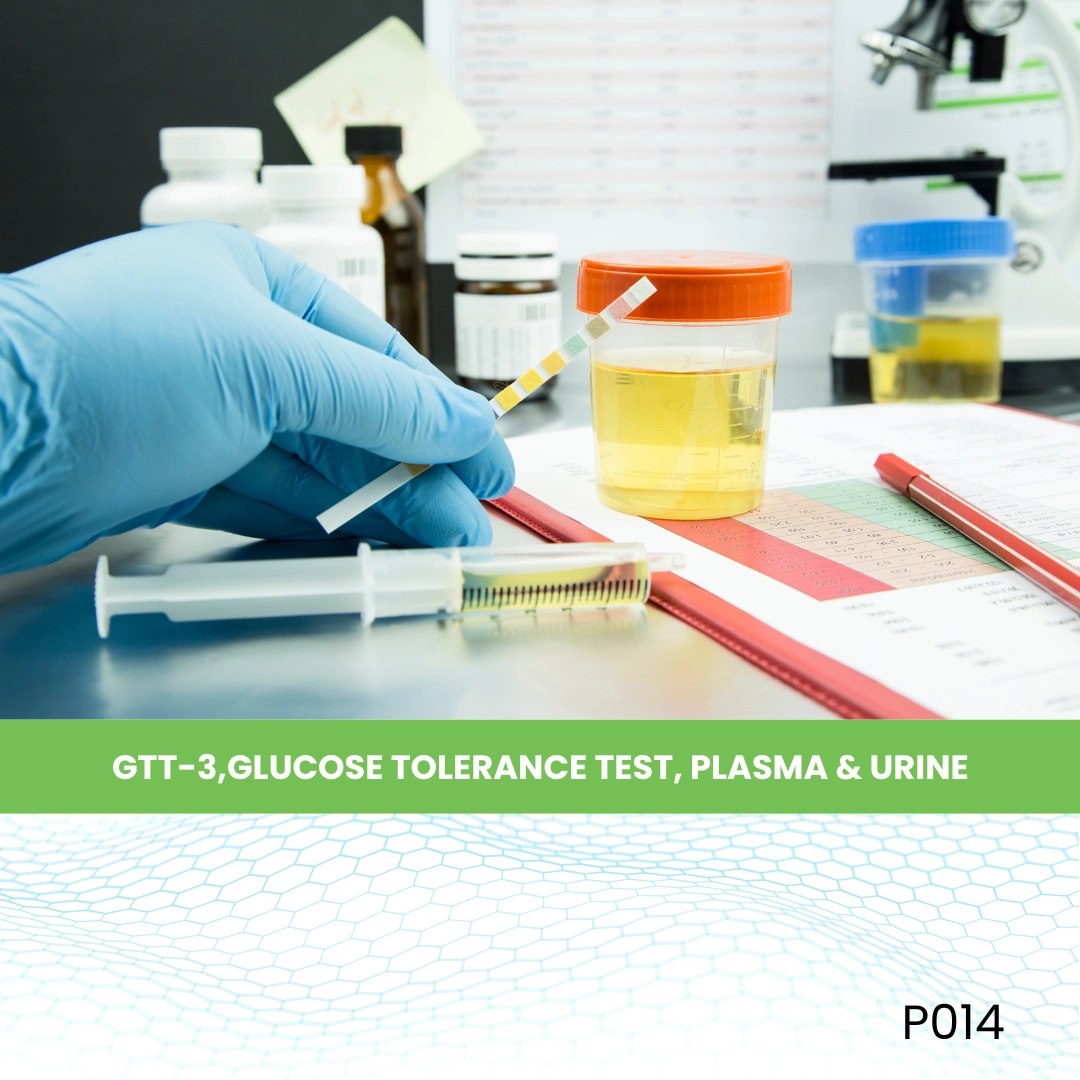 GTT-3,GLUCOSE TOLERANCE TEST, PLASMA & URINE