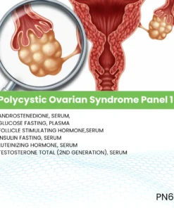 Polycystic Ovarian Syndrome Panel 1