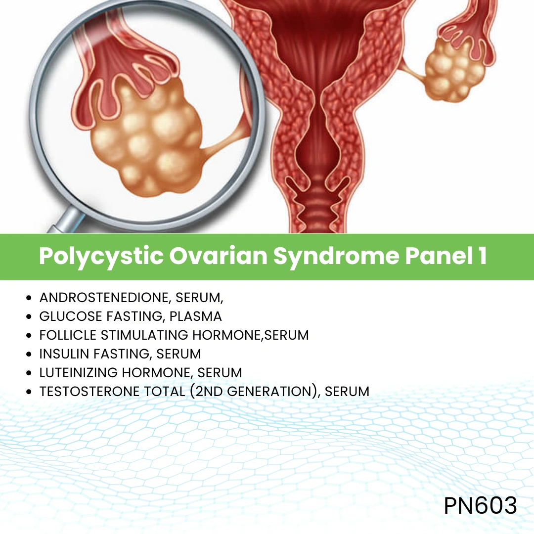 Polycystic Ovarian Syndrome Panel 1