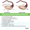 Polycystic Ovarian Syndrome Panel 2