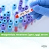 Phospholipid Antibodies (Igm & Igg), Serum