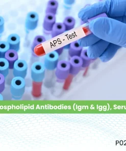 Phospholipid Antibodies (Igm & Igg), Serum