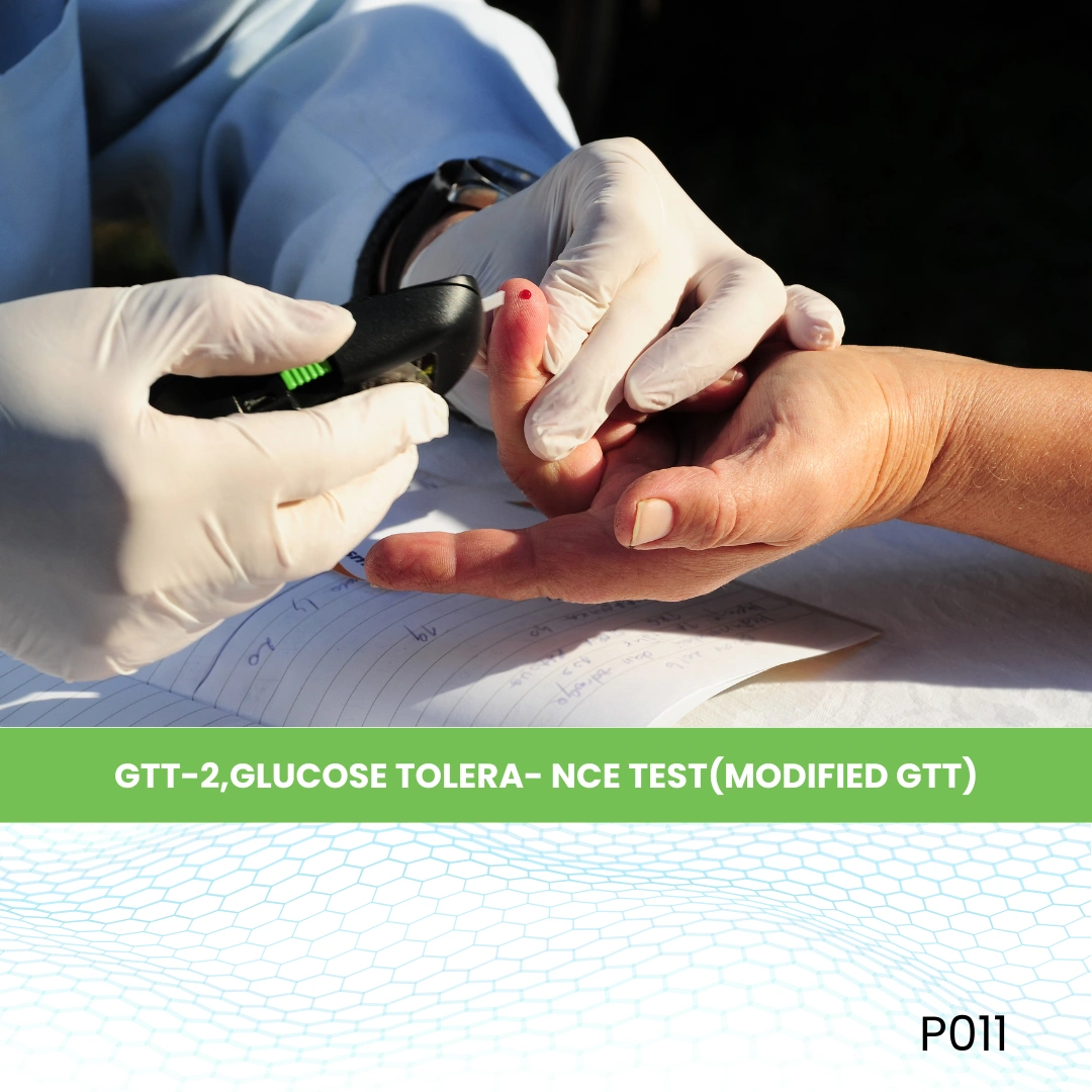 GTT-2,GLUCOSE TOLERA- NCE TEST(MODIFIED GTT)