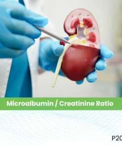Microalbumin / Creatinine Ratio