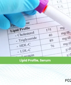 Lipid Profile, Serum