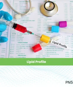 Lipid Profile.